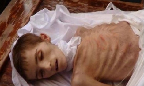   به‌ وێنه‌.. منداڵانی مه‌زایا له‌ برسان ده‌مرن